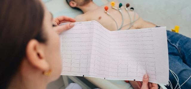 wykres ekg pacjenta