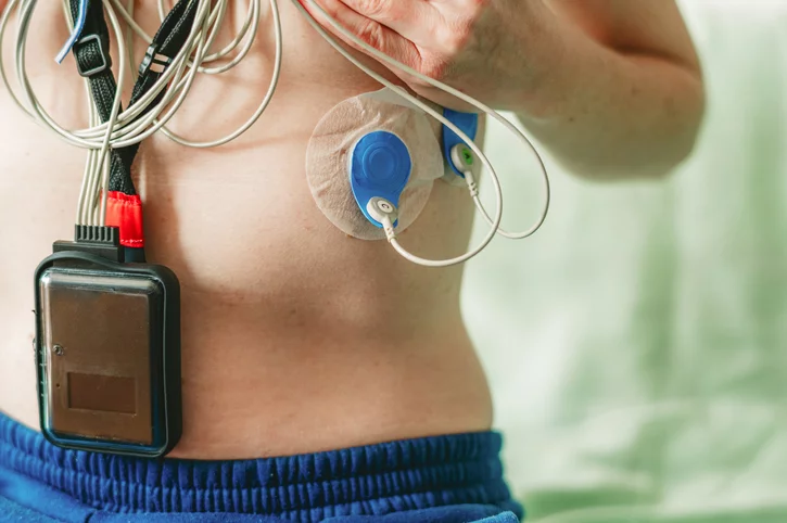 założony holter EKG